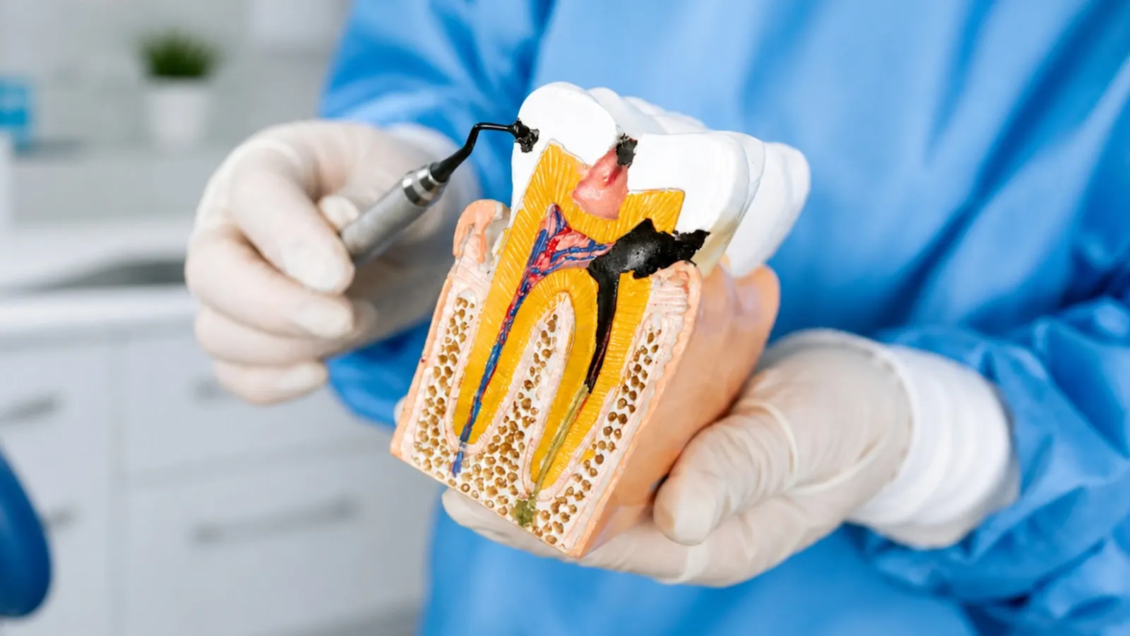 Cross-section of a tooth: pulp chamber and root canals